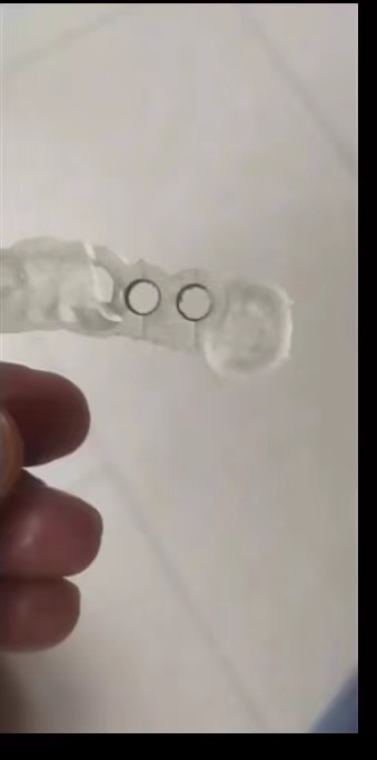 Resin Dental 3D Printer Planti - đánh giá và giá 3D Printing Dental