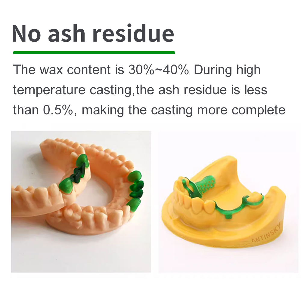 Antinsky Castable Dental Smart - đánh giá và giá 3D Printing Dental