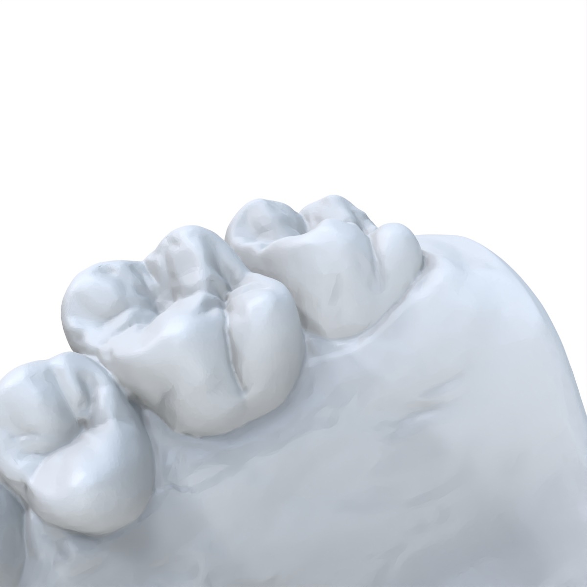 1 PCS Dental Model Preferred 3 - đánh giá và giá 3D Printing Dental